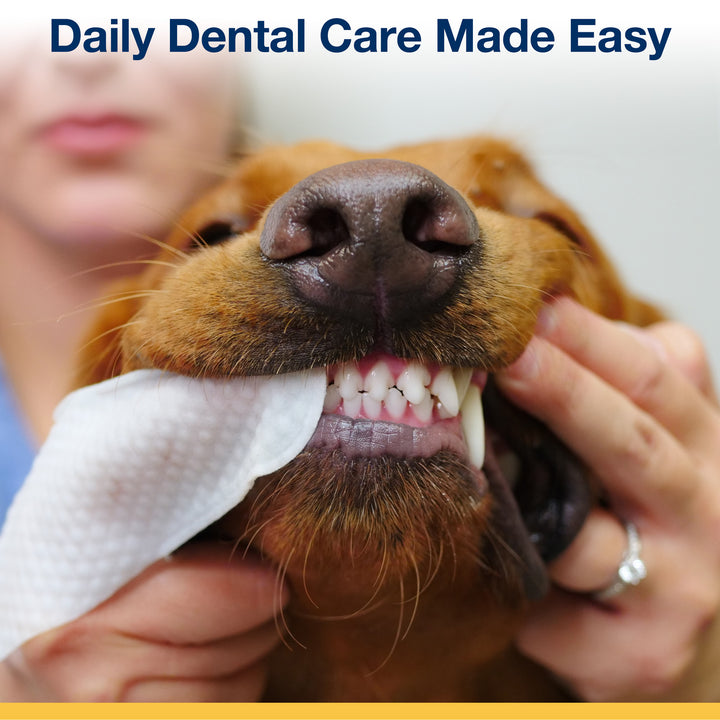 ProDen Dental Finger Wipes (50 Wipes)