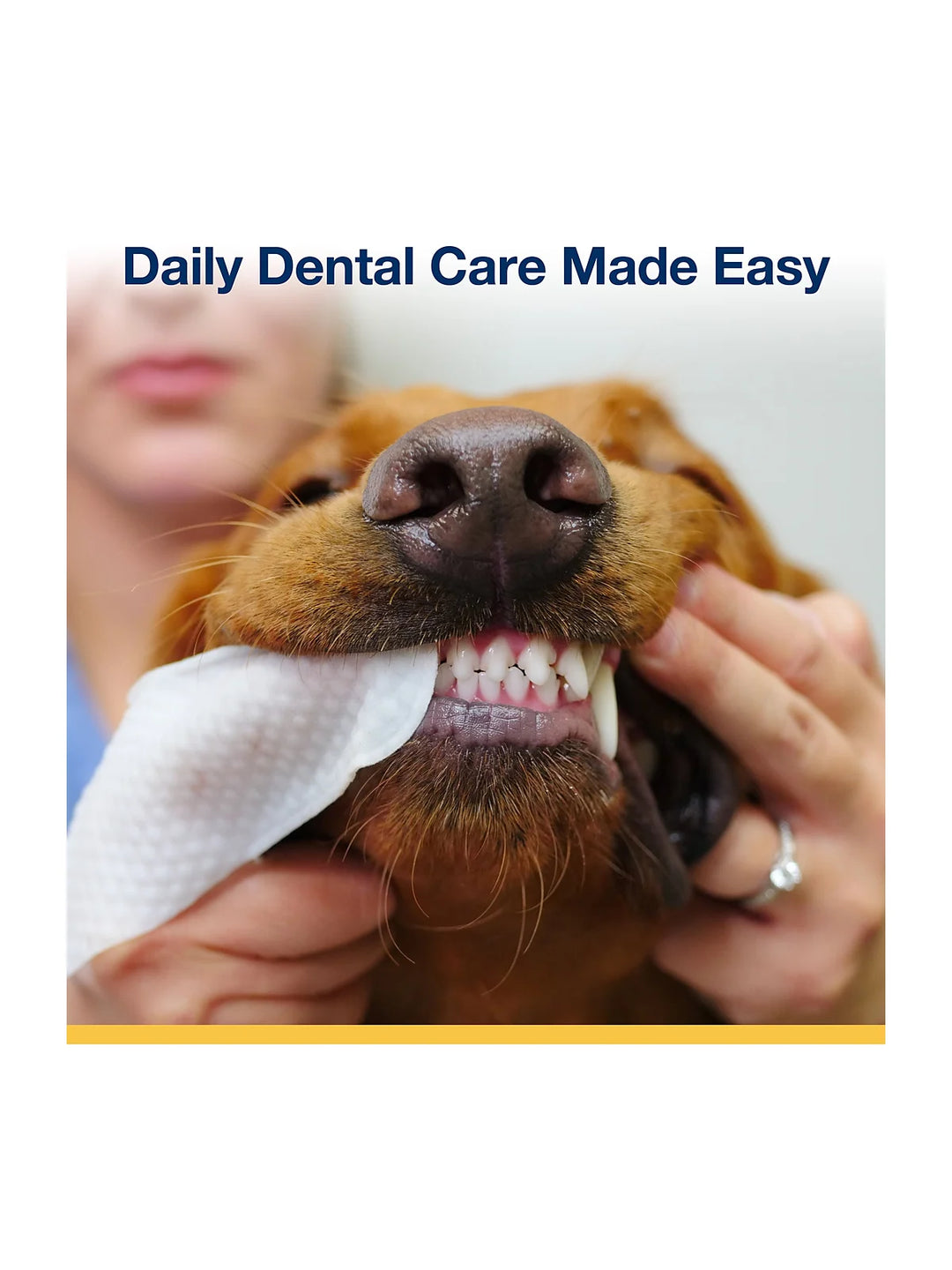 ProDen Dental Finger Wipes (50 Wipes)